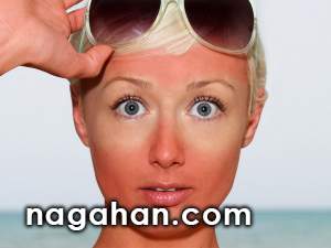 همه چیز درباره آفتاب سوختگی صورت و بدن در تابستان | علت، تسکین و درمان موثر برای رفع تیرگی پوست